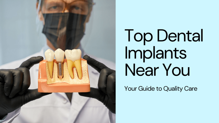 Best Dental Clinics for Implants in USA